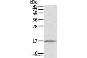 Western blot analysis of Human normal liver tissue, using EVA1A Polyclonal Antibody at dilution of 1:550 (TMEM166 抗体)