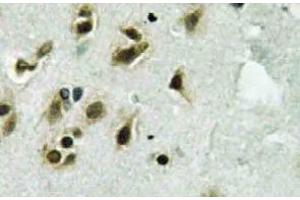 Immunohistochemistry  (IHC) analyzes of TFIIIC102 antibody in paraffin-embedded human brain tissue. (GTF3C3 抗体)