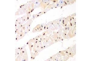 Immunohistochemistry (Paraffin-embedded Sections) (IHC (p)) image for anti-Non-POU Domain Containing, Octamer-Binding (NONO) (AA 1-300) antibody (ABIN6144713)