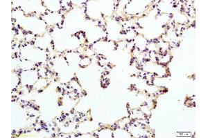 Immunohistochemistry (Paraffin-embedded Sections) (IHC (p)) image for anti-Interleukin 12 Receptor, beta 2 (IL12RB2) (AA 301-400) antibody (ABIN747878)
