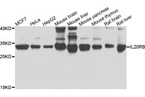 Western blot analysis of extracts of various cell lines, using IL20RB antibody. (IL20RB 抗体)