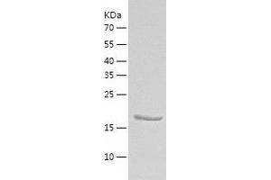 Western Blotting (WB) image for Cyclin-Dependent Kinase Inhibitor 1B (p27, Kip1) (CDKN1B) (AA 1-198) protein (His-IF2DI Tag) (ABIN7122538)