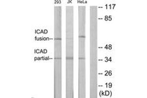 Western blot analysis of extracts from Jurkat/293/HeLa cells, using DFFA Antibody. (DFFA 抗体  (AA 151-200))