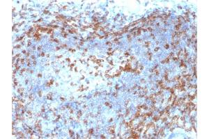 Formalin-fixed, paraffin-embedded human Lymph Node stained with ZAP70 Mouse Monoclonal Antibody (ZAP70/2046). (ZAP70 抗体  (AA 247-382))