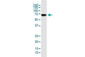 ENG monoclonal antibody (M26), clone 1E5. (Endoglin 抗体  (AA 27-658))