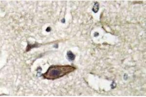 Immunohistochemistry (IHC) analyzes of Tsg 101 antibody in paraffin-embedded human brain tissue. (TSG101 抗体)