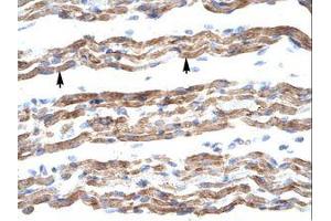 Image no. 1 for anti-Polyglutamine Binding Protein 1 (PQBP1) (AA 58-107) antibody (ABIN202137) (PQBP1 抗体  (AA 58-107))
