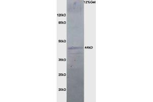 Rat brain lysate probed with Anti PDSS2 Polyclonal Antibody, Unconjugated (ABIN1386354) at 1:200 in 4 °C. (PDSS2 抗体  (AA 21-100))