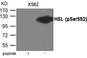Western blot analysis of extracts from K562 cells using HSL (Phospho-Ser552) Antibody. (LIPE 抗体  (pSer552))
