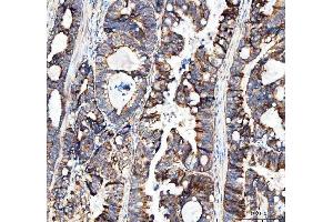 IHC analysis of MUT using anti-MUT antibody (ABIN4886676). (MUT 抗体  (N-Term))