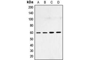 Western blot analysis of SMAD4 expression in HepG2 (A), HeLa (B), NIH3T3 (C), COS7 (D) whole cell lysates. (SMAD4 抗体  (N-Term))