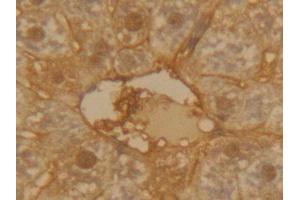 IHC-P analysis of Mouse Liver Tissue, with DAB staining. (SERPINA1 抗体  (AA 25-413))