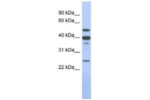 MMP13 antibody used at 1 ug/ml to detect target protein. (MMP13 抗体)