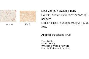 Sample Type: Human Optic Nerve and Spinal CordCellular Target: Oligoden Drocyte Lineage CellsPrimary Dilution: IHC-PZ 1:500, IHC-P 1:1000 (Nkx2-2 抗体  (N-Term))