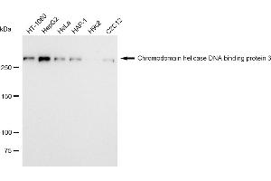 Western blotting analysis using Chromodomain helicase DNA binding protein 3 antibody (ABIN7798069). (Recombinant CHD3 抗体)