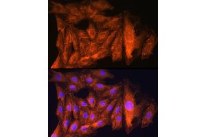 Immunofluorescence analysis of Rat H9C2 cells using CK antibody (ABIN6127628, ABIN6138647, ABIN6138648 and ABIN6224627) at dilution of 1:100.