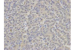 Immunohistochemistry (IHC) image for anti-Proteasome (Prosome, Macropain) 26S Subunit, ATPase, 2 (PSMC2) antibody (ABIN1874379) (PSMC2 抗体)