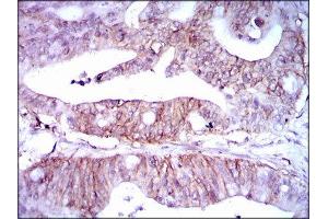 Immunohistochemistry (IHC) image for anti-Lipoprotein (Lp(a)) (AA 4330-4521) antibody (ABIN1845714) (Lp(a) 抗体  (AA 4330-4521))