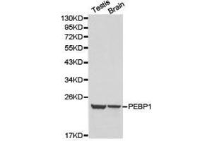 Western Blotting (WB) image for anti-Phosphatidylethanolamine Binding Protein 1 (PEBP1) antibody (ABIN1874092) (PEBP1 抗体)