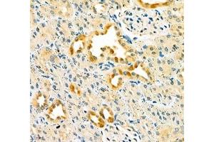 Immunohistochemistry of paraffin embedded rat kidney using Dmac2l (ABIN7073751) at dilution of 1: 650 (400x lens) (Distal Membrane Arm Assembly Complex 2 L Homeolog (DMAC2.L) 抗体)