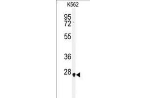 Western blot analysis of HMGB2 antibody (Center) in K562 cell line lysates (35 µg/lane). (HMGB2 抗体  (Middle Region))