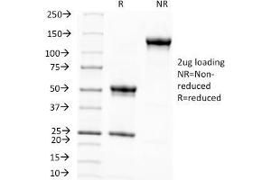 SDS-PAGE Analysis Purified Melanoma Monoclonal Antibody (KBA. (Melanoma Associated Antigen (KBA.62) 抗体)