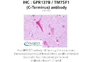 Image no. 2 for anti-G Protein-Coupled Receptor 137B (GPR137B) (C-Term) antibody (ABIN1734939) (GPR137B 抗体  (C-Term))