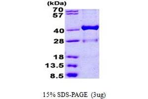 Hydroxysteroid (17-Beta) Dehydrogenase 1 (HSD17B1) (AA 1-328) protein (His tag)