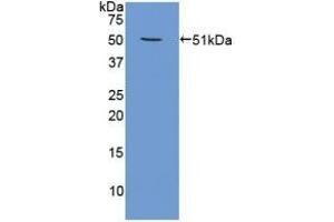 Western Blotting (WB) image for anti-Proteasome (Prosome, Macropain) 26S Subunit, ATPase, 4 (PSMC4) (AA 1-418) antibody (ABIN7442066)