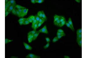 Immunofluorescence (IF) image for anti-Transcription Factor B1, Mitochondrial (TFB1M) (AA 59-194) antibody (ABIN7149946)