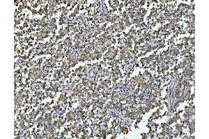 IHC analysis of ARL13B using anti-ARL13B antibody (ABIN7600179).