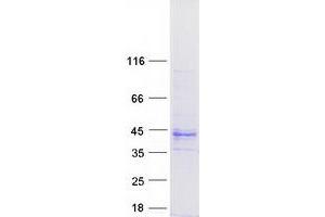 Validation with Western Blot
