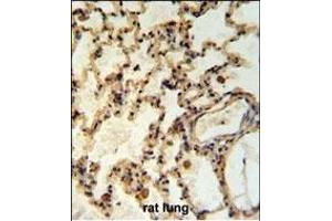 IL Antibody (Center) (ABIN653951 and ABIN2843173) IHC analysis in formalin fixed and paraffin embedded rat lung tisssue followed by peroxidase conjugation of the secondary antibody and DAB staining. (IMMP2L 抗体  (AA 81-109))