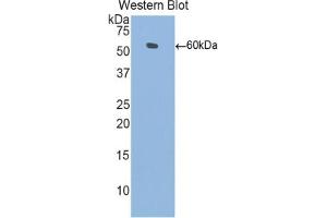 Western blot analysis of the recombinant protein. (L1CAM 抗体  (AA 882-1132))