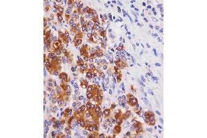 (ABIN6243770 and ABIN6577238) staining REG3G in human pancreas tissue sections by Immunohistochemistry (IHC-P - paraformaldehyde-fixed, paraffin-embedded sections). (REG3g 抗体)