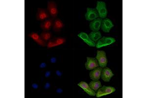 Phospho-XBP1 (Ser68) Antibody staining Hela cells(heat shock treatment) by IF/ICC. (XBP1 抗体  (pSer68))