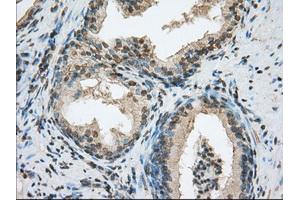 Immunohistochemical staining of paraffin-embedded colon tissue using anti-ACSBG1 mouse monoclonal antibody. (ACSBG1 抗体)