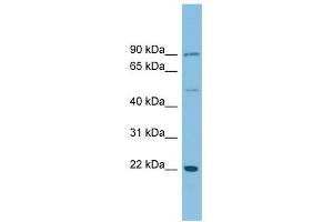 DNAJC12 antibody used at 1 ug/ml to detect target protein. (DNAJC12 抗体)
