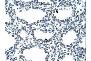 Image no. 1 for anti-Transformer 2 beta Homolog (TRA2B) (N-Term) antibody (ABIN202162) (TRA2B 抗体  (N-Term))