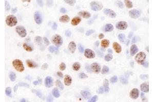 Immunohistochemistry (IHC) image for anti-H2A Histone Family, Member X (H2AFX) (C-Term) antibody (ABIN7448589) (H2AFX 抗体  (C-Term))
