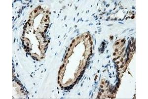 Immunohistochemical staining of paraffin-embedded liver tissue using anti-TPMT mouse monoclonal antibody. (TPMT 抗体)