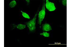 Immunofluorescence of purified MaxPab antibody to HYAL3 on HeLa cell. (HYAL3 抗体  (AA 1-417))