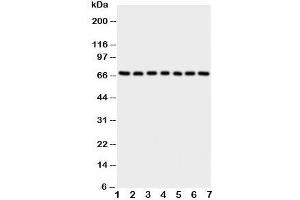 Western blot testing of NOX4 antibody and Lane 1:  rat kidney;  2: (r) heart;  3: (r) spleen;  4: human HeLa;  5: (h) 293T;  6: (h) MCF-7;  7: (h) SMMC-7721 cell lysate. (NADPH Oxidase 4 抗体  (C-Term))