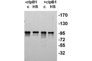 Western Blotting (WB) image for anti-ClpB2 Gene Product (CLPB2) antibody (ABIN334578) (CLPB2 抗体)