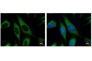 ICC/IF Image HADHA antibody detects HADHA protein at Mitochondria by immunofluorescent analysis. (HADHA 抗体  (C-Term))
