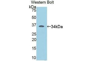 Western blot analysis of the recombinant protein. (RELB 抗体  (AA 176-436))