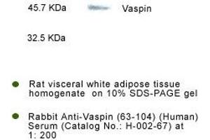 Detection of Vaspin in rat visceral fat tissue by Western Blot Kit (SERPINA12 抗体  (AA 63-104))