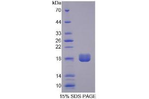 Image no. 1 for Phosphatidic Acid Phosphatase Type 2B (PPAP2B) (AA 57-194) protein (His tag) (ABIN6239628) (PPAP2B Protein (AA 57-194) (His tag))