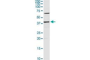 SERPINB2 MaxPab rabbit polyclonal antibody. (SERPINB2 抗体  (AA 1-415))