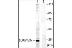 Western blot analysis of extracts from mouse lung cells, using Survivin Antibody . (Survivin 抗体)